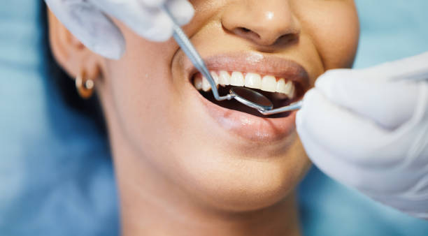 Best Emergency Dentist for Special Needs Patients in Fort Belvoir, VA